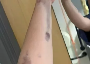 Val de gripă în România: numărul cazurilor a explodat în ultimele săptămâni