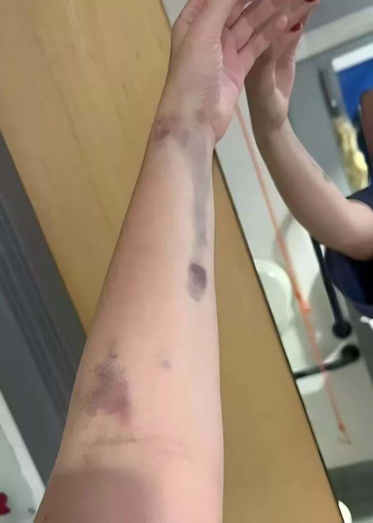 Val de gripă în România: numărul cazurilor a explodat în ultimele săptămâni